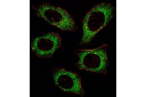 Fluorescent image of U251 cell stained with MAP2K2 Antibody (T394). (MEK2 抗体  (AA 372-400))