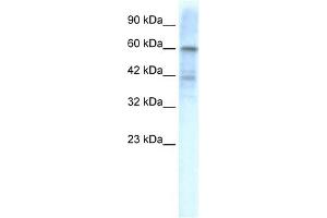 WB Suggested Anti-KCND3 Antibody Titration:  1. (KCND3 抗体  (Middle Region))