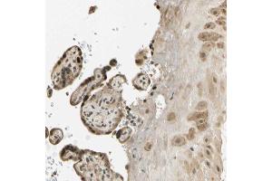 Immunohistochemical staining (Formalin-fixed paraffin-embedded sections) of human placenta with FGF3 polyclonal antibody  shows strong nuclear and cytoplasmic positivity in trophoblastic cells and moderate cytoplasmic positivity in decidual cells. (FGF3 抗体  (AA 102-223))