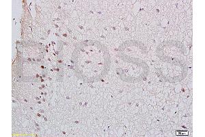 Formalin-fixed and rat brain tissue labeled with Anti-GTPBP10 Polyclonal Antibody (ABIN750748), Unconjugated at 1:200 followed by conjugation to the secondary antibody and DAB staining (GTPBP10 抗体  (AA 151-250))