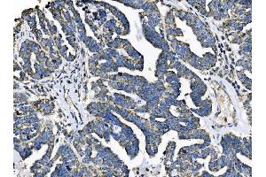 IHC analysis of TOMM70 using anti-TOMM70 antibody (ABIN7599855). (TOM70 抗体  (AA 122-608))