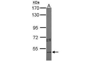 Western Blotting (WB) image for anti-serine/threonine Kinase 4 (STK4) (C-Term) antibody (ABIN2856667)