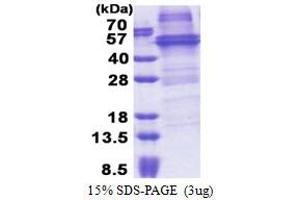 SDS-PAGE (SDS) image for RNA-Binding Protein NOB1 (NOB1) (AA 1-412) protein (His tag) (ABIN5853244) (NOB1 Protein (AA 1-412) (His tag))