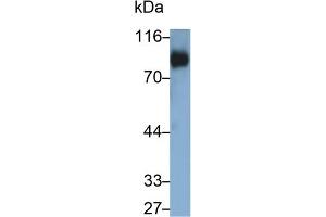Detection of CD42d in Human Platelet lysate using Polyclonal Antibody to Cluster of Differentiation 42d (CD42d) (GP5 抗体  (AA 17-242))