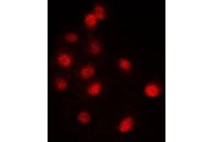 Immunofluorescent analysis of SNRP116 staining in NIH3T3 cells.