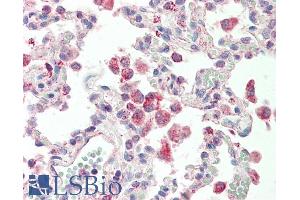 ABIN5539834 (5µg/ml) staining of paraffin embedded Human Lung. (GLRA1 抗体  (Internal Region))
