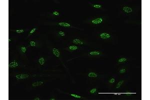 Immunofluorescence of monoclonal antibody to TGIF2 on HeLa cell. (TGIF2 抗体  (AA 114-175))