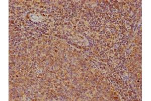 IHC image of ABIN7167999 diluted at 1:200 and staining in paraffin-embedded human tonsil tissue performed on a Leica BondTM system. (ROCK1 抗体  (AA 405-668))