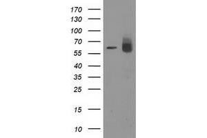 Western Blotting (WB) image for anti-Acyl-CoA Thioesterase 12 (ACOT12) antibody (ABIN1496417) (ACOT12 抗体)