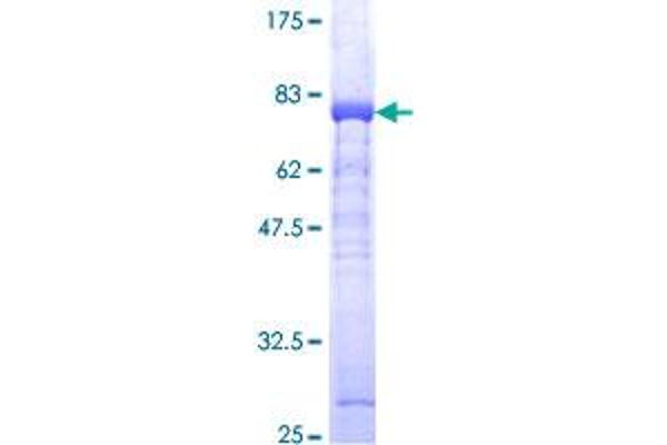 ADK Protein (AA 1-345) (GST tag)