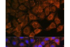 Immunofluorescence analysis of HeLa cells using MYO6 Polyclonal Antibody at dilution of 1:100. (Myosin VI 抗体)