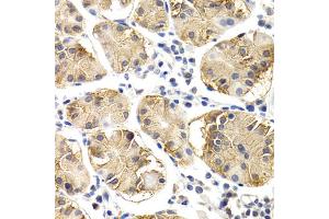 Immunohistochemistry of paraffin-embedded human normal stomach using CHIT1 antibody. (Chitotriosidase 1 抗体)