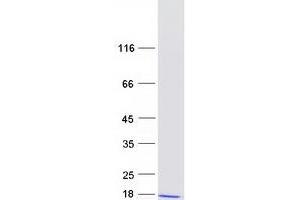 Validation with Western Blot