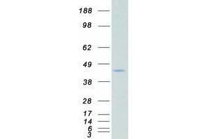 Western Blotting (WB) image for Casein Kinase 2, alpha Prime Polypeptide (CSNK2A2) protein (Myc-DYKDDDDK Tag) (ABIN2712583)