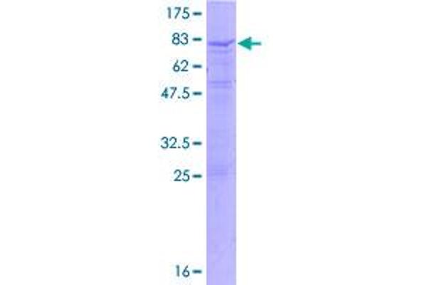 IL17RC Protein (AA 1-538) (GST tag)