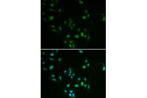 Immunofluorescence analysis of MCF7 cell using BCL2 antibody. (Bcl-2 抗体)