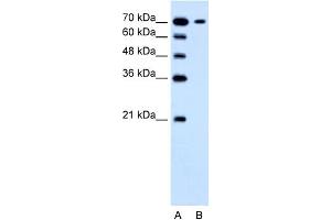 WB Suggested Anti-SLC5A4 Antibody Titration:  1. (SLC5A4 抗体  (N-Term))