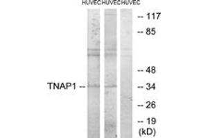 Western blot analysis of extracts from HuvEc cells, treated with PMA 125ng/ml 30', using TNAP1 Antibody. (TNFAIP1 抗体  (AA 71-120))