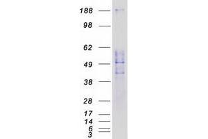 Validation with Western Blot