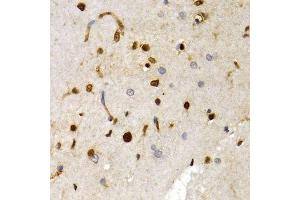 Immunohistochemistry (Paraffin-embedded Sections) (IHC (p)) image for anti-SRY (Sex Determining Region Y)-Box 2 (SOX2) (AA 1-140) antibody (ABIN3021003)