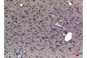Immunohistochemistry (IHC) analysis of paraffin-embedded Rat Brain, antibody was diluted at 1:100.