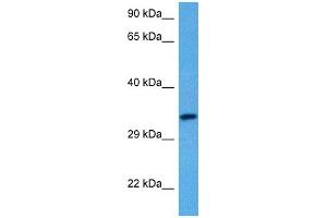 Host:  Rabbit  Target Name:  SLC29A3  Sample Tissue:  Human Uterus Tumor lysates  Antibody Dilution:  1ug/ml (SLC29A3 抗体  (C-Term))