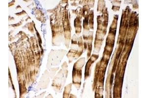 IHC testing of FFPE mouse skeletal muscle with ACTN3 antibody at 1ug/ml. (ACTN3 抗体  (AA 574-617))
