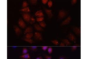 Immunofluorescence analysis of HeLa cells using HRNR Polyclonal Antibody at dilution of 1:100 (40x lens). (HRNR 抗体)