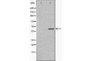 Western blot analysis of Smad7 expression in Human Kidney lysate,The lane on the left is treated with the antigen-specific peptide. (SMAD7 抗体  (N-Term))