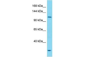 Western Blotting (WB) image for anti-Unc-51 Like Kinase 1 (ULK1) (N-Term) antibody (ABIN2785618) (ULK1 抗体  (N-Term))