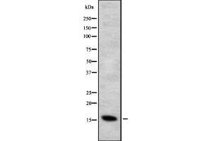 Western blot analysis of CYB5B expression in HEK293 cells ,The lane on the left is treated with the antigen-specific peptide. (CYB5B 抗体  (Internal Region))