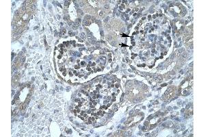 Lipase antibody (Pancreatic) was used for immunohistochemistry at a concentration of 4-8 ug/ml to stain Epithelial cells of renal corpuscle (lndicated with Arrows) in Human Kidney. (PNLIP 抗体  (C-Term))