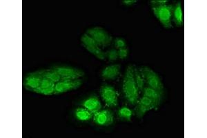 Immunofluorescent analysis of HepG2 cells using ABIN7150247 at dilution of 1:100 and Alexa Fluor 488-congugated AffiniPure Goat Anti-Rabbit IgG(H+L) (POLH 抗体  (AA 408-609))