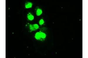 Anti-SSB mouse monoclonal antibody (ABIN2452278) immunofluorescent staining of COS7 cells transiently transfected by pCMV6-ENTRY SSB (RC205013). (SSB 抗体)
