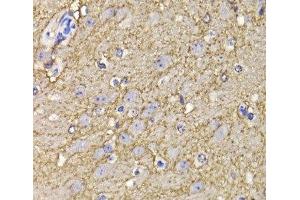 Immunohistochemistry of paraffin-embedded Mouse brain using KCND3 Polyclonal Antibody at dilution of 1:100 (40x lens). (KCND3 抗体)