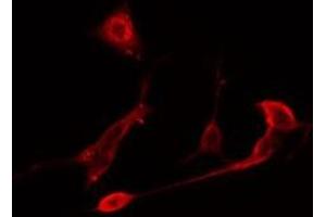 ABIN6275758 staining  NIH-3T3 cells by IF/ICC. (DUSP10 抗体  (Internal Region))