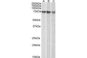 ABIN184639 (1µg/ml) staining of HepG2 (A), K562 (B) and HeLa (C) nuclear lysates (35µg protein in RIPA buffer). (ATF2 抗体  (C-Term))