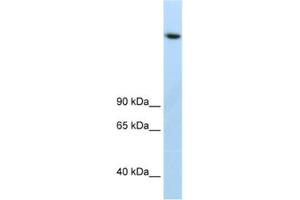 Western Blotting (WB) image for anti-Lysine (K)-Specific Demethylase 3B (KDM3B) antibody (ABIN2461878) (KDM3B 抗体)