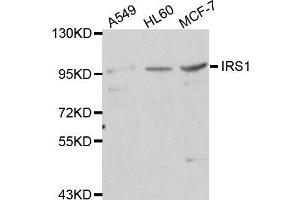 Western blot analysis of extracts of various cell lines, using IRS1 antibody. (IRS1 抗体)
