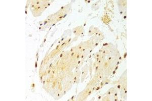 Immunohistochemistry of paraffin-embedded Human esophageal using DKC1 antibody at dilution of 1:100 (x400 lens). (DKC1 抗体)