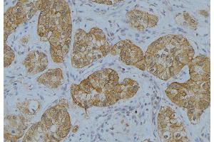 ABIN6273650 at 1/100 staining Human uterus tissue by IHC-P. (IL-13 抗体  (N-Term))
