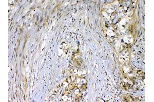 IHC analysis of VEGF Receptor 2  using anti-VEGF Receptor 2  antibody . (VEGFR2/CD309 抗体  (AA 20-242))