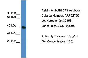 WB Suggested Anti-UBLCP1  Antibody Titration: 0. (UBLCP1 抗体  (N-Term))