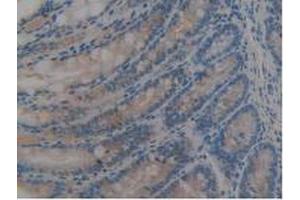 IHC-P analysis of Mouse Large Intestine Tissue, with DAB staining. (REG3B 抗体  (AA 27-175))
