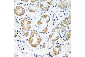 Immunohistochemistry of paraffin-embedded human stomach using OXCT1 antibody at dilution of 1:100 (40x lens). (OXCT1 抗体)