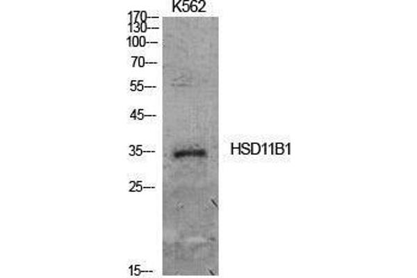 HSD11B1 抗体  (Internal Region)