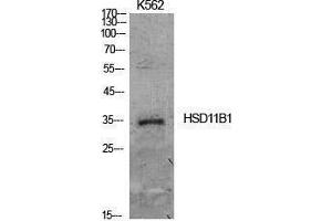 Western Blotting (WB) image for anti-Hydroxysteroid (11-Beta) Dehydrogenase 1 (HSD11B1) (Internal Region) antibody (ABIN3181414) (HSD11B1 抗体  (Internal Region))