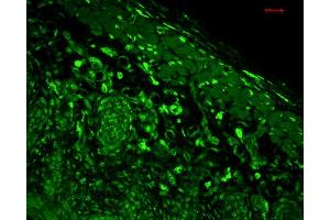 Immunohistochemistry analysis using Mouse Anti-HO-1 Monoclonal Antibody, Clone 1F12-A6 . (HMOX1 抗体  (AA 1-30) (PE))