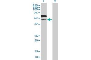Western Blot analysis of PKLR expression in transfected 293T cell line by PKLR MaxPab polyclonal antibody. (PKLR 抗体  (AA 1-574))