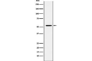 Western blot analysis of MMP1 expression in A431 cell lysate.